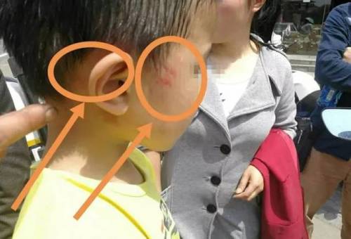 第336页